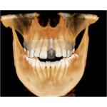 GENDEX CB-500 CONE BEAM