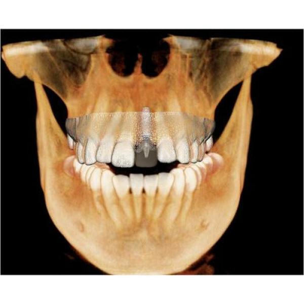 GENDEX CB-500 CONE BEAM