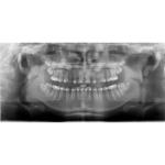 GENDEX CB-500 CONE BEAM