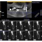 GENDEX CB-500 CONE BEAM
