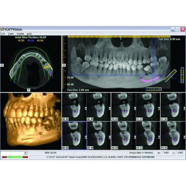 GENDEX CB-500 CONE BEAM