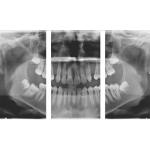 CARESTREAM CS 9000C 3D PANOREX + CEPH + CONE BEAM