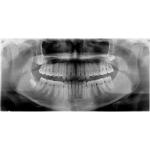 CARESTREAM CS 9000C 3D PANOREX + CEPH + CONE BEAM