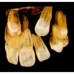 CARESTREAM CS 9000C 3D PANOREX + CEPH + CONE BEAM