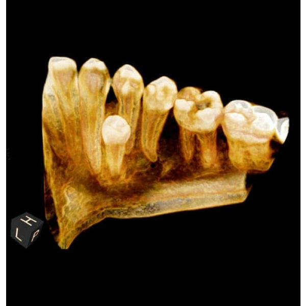 CARESTREAM CS 9000C 3D PANOREX + CEPH + CONE BEAM