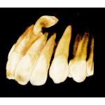 CARESTREAM CS 9000C 3D PANOREX + CEPH + CONE BEAM