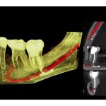 CARESTREAM CS 9000C 3D PANOREX + CEPH + CONE BEAM