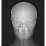 CARESTREAM CS 9000C 3D PANOREX + CEPH + CONE BEAM