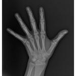 CARESTREAM CS 9000C 3D PANOREX + CEPH + CONE BEAM