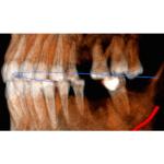 INSTRUMENTARIUM OP300 PANOREX + CONE BEAM