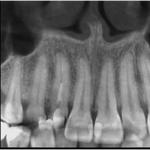 INSTRUMENTARIUM OP300 PANOREX + CONE BEAM