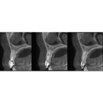 INSTRUMENTARIUM OP300 PANOREX + CONE BEAM