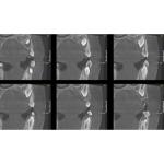 INSTRUMENTARIUM OP300 PANOREX + CONE BEAM
