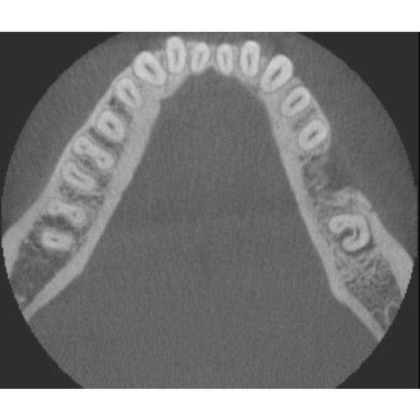 INSTRUMENTARIUM OP300 PANOREX + CONE BEAM