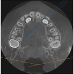 INSTRUMENTARIUM OP300 PANOREX + CONE BEAM