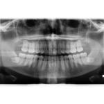 INSTRUMENTARIUM OP300 PANOREX + CONE BEAM