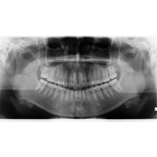 KAVO OP 3D PRO PANOREX + CONE BEAM